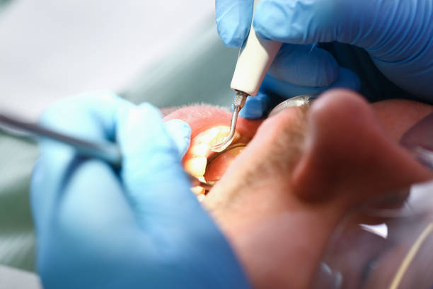 Best Urgent Care for Lost Fillings or Crowns in Weaverville, CA