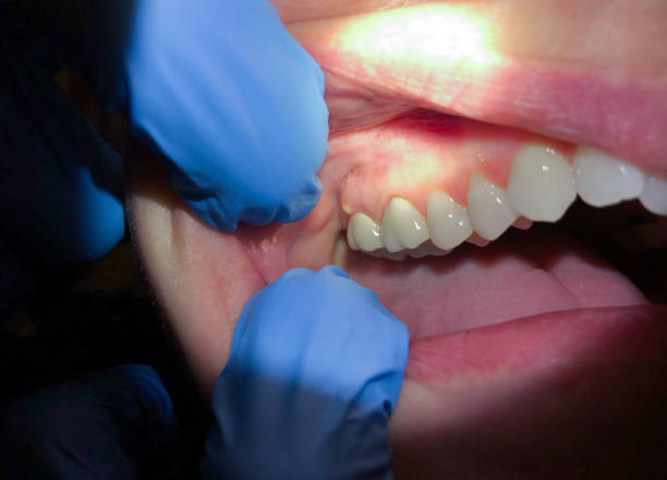 Best After-Hours Dental Trauma Care in Weaverville, CA