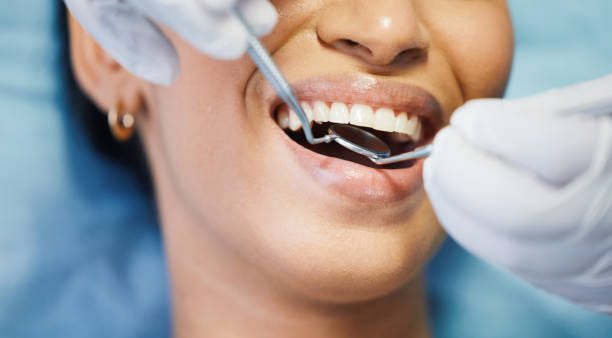 Best Emergency Treatment for Dental Infections or Abscesses in Weaverville, CA