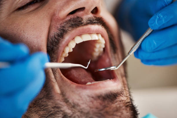 Best Emergency Denture Repair in Weaverville, CA