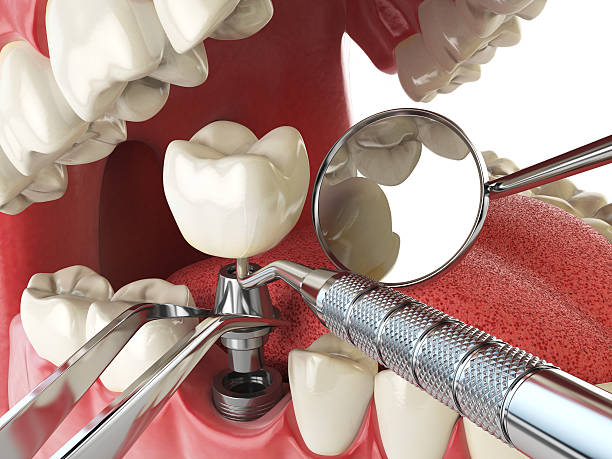 Best Weekend Emergency Dentist in Weaverville, CA